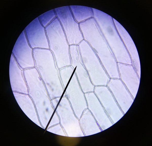 Cellules Observ Es Au Microscope Svt Noyau Cytoplasme Membrane Plasmique Vive Les Svt